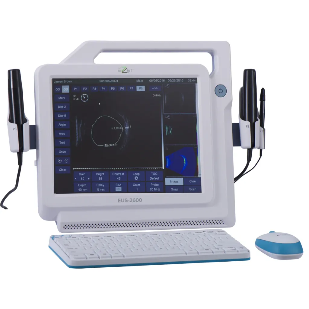 ULTRASOUND A/B-SCAN – MARVEL 2