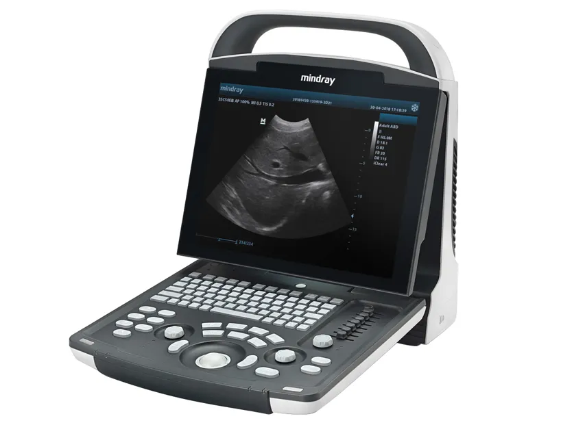 [1115] DP 20 mindry ultrasound machine
