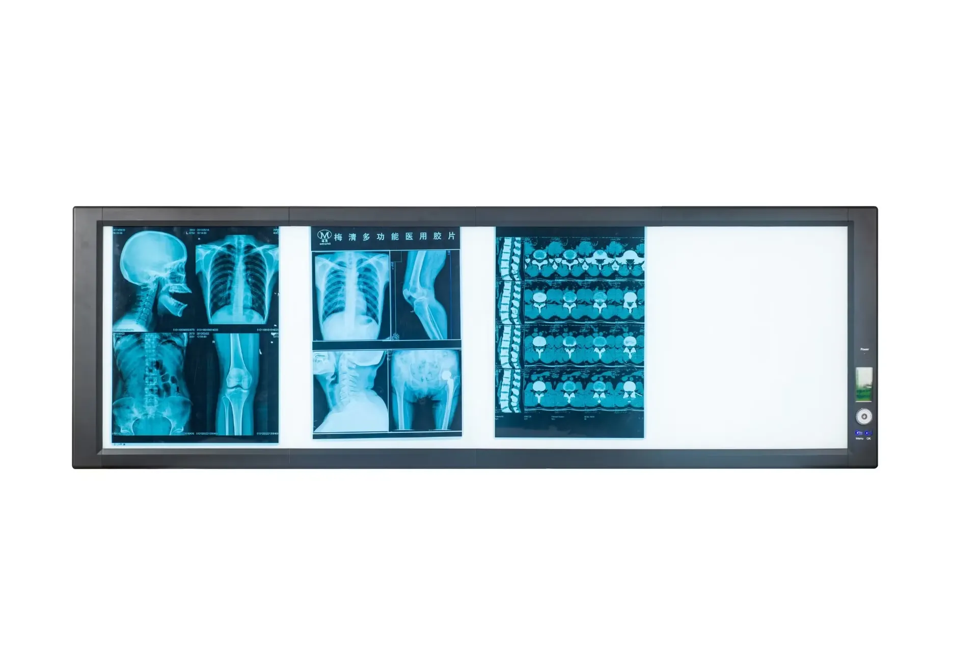 [1198] ECOMED Visualiseur de radiographies numérique EV-360 MT – Illuminateur de films médicaux LED haute luminosité (vue simple/double)