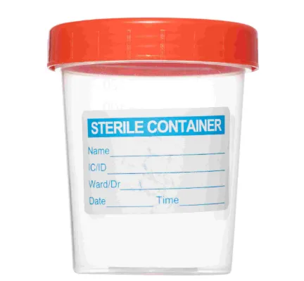 [3711] Specimen Jar – Sterile, Leak-Proof Container for Clinical Sample Collection