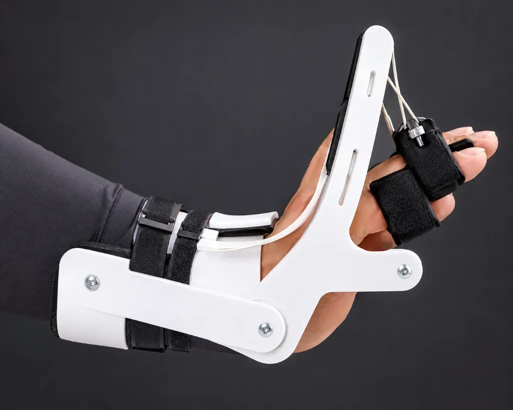 Dynamic Radial Nerve Palsy Splint – Adjustable Wrist & Finger Extension Rehabilitation Orthosis