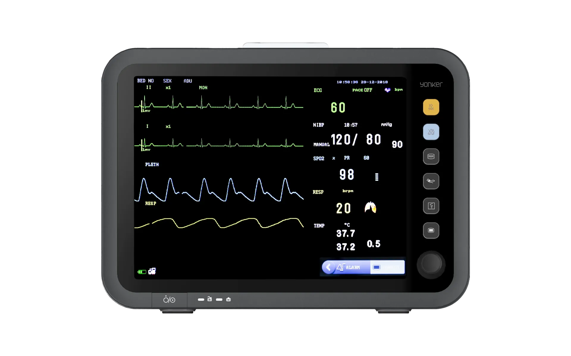 Yonker 5-Parameter Patient Monitor with Mobile Trolley Stand