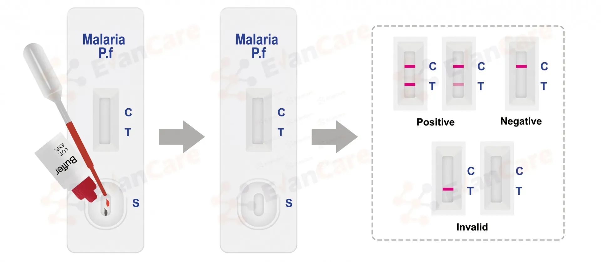  Malaria Plasmodium falciparum (Pf) Antigen Test Cassette (WB) | Pack of 25 Tests (Any Generic Brand)