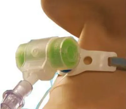HME Filter Tracheostomy (T-Type with Oxygen Tube) | Heat & Moisture Exchanger with O₂ Port