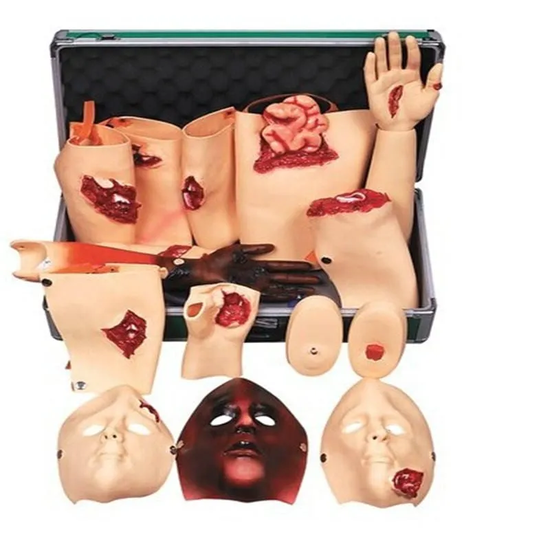 Trauma Model